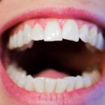 Ładne zdrowe zęby także efektowny uroczy uśmieszek to powód do zadowolenia.